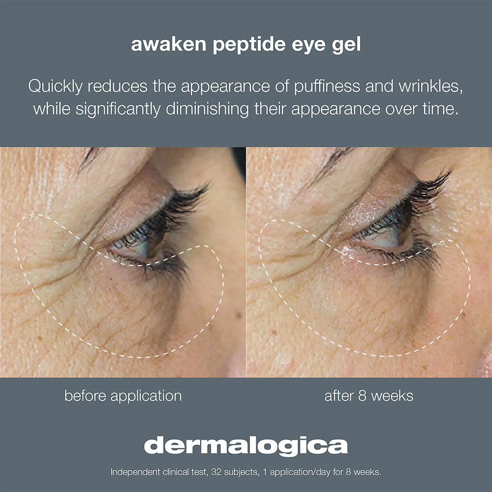 Dermalogica Awaken Peptide Depuffing Eye Gel – All Dolled Up Bar